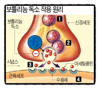 양천구보톡스 눈에 띄는 변화는 언제부터 생기는 걸까? 관련 이미지 3