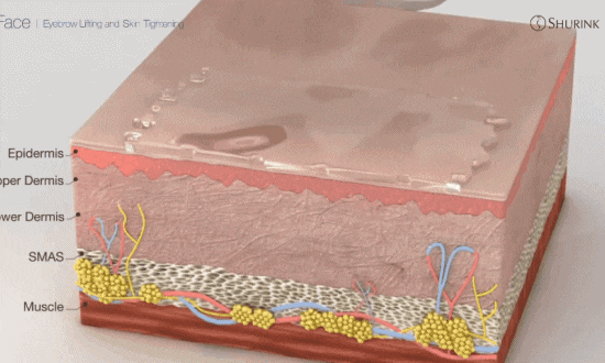 Mokdong Shurink: If You Need Wrinkle and Elasticity Improvement image 2