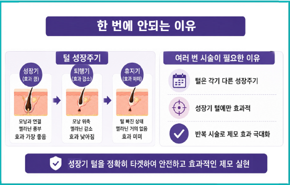 Mokdong Station Laser Hair Removal: Why Is It Also Possible for Sensitive Skin? image 6