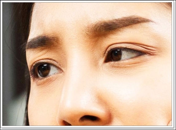 Mokdong Thermage: Is More Shots Better? image 4