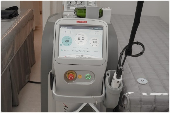 DermaV Laser Helps With More Than Pigment Treatment Alone — It Also Helps With OO image 2