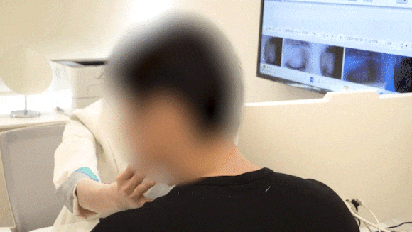 양천구보톡스 눈에 띄는 변화는 언제부터 생기는 걸까? 관련 이미지 7