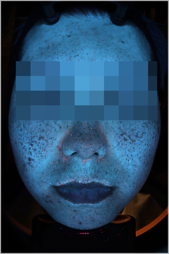 Omokgyo Dermatology Clinic, If Numerous Blemishes Make Your Skin Tone Look Dull? (Department: Dermatology) image 7