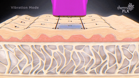 A Complete Guide to Firming Solutions with Thermage in Mok-dong image 2