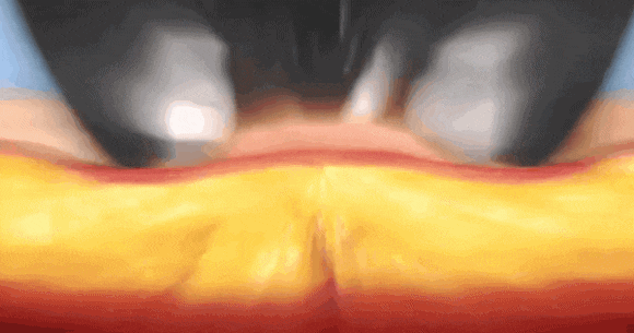 Omokgyo InMode: If You Want a Firm Yet Slim Face image 2