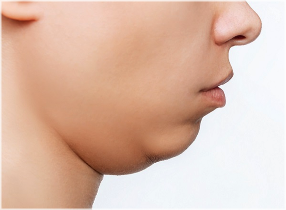 If You’re Looking for a Way to Enhance the Jawline with Mokdong Filler image 2