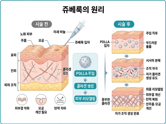 Mokdong Juvelook: When Can You Expect Improvements in Pores and Fine Lines? image 2