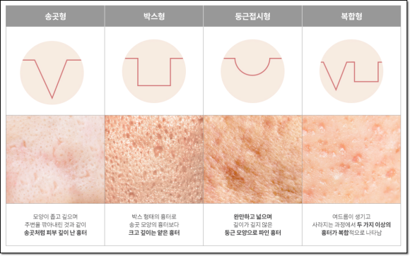 목동쥬베룩, 효과 없었다는 후기는 뭘까? 관련 이미지 7