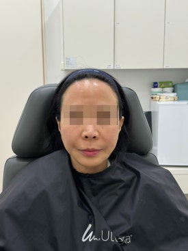 목동역실리프팅 윤곽정리가 필요하다면 관련 이미지 5