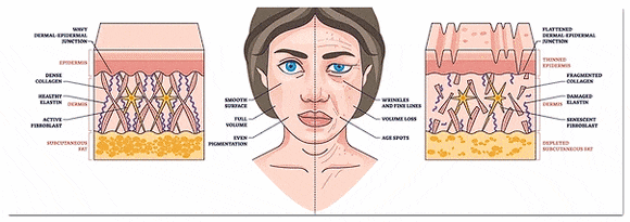 When Fillers Alone Aren’t Enough: Mokdong Thread Lifting image 2
