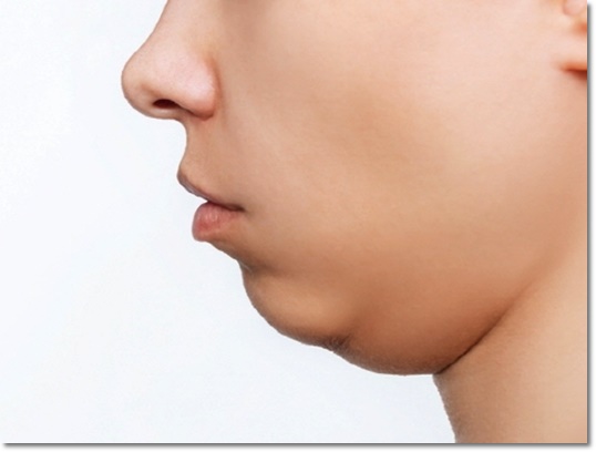 Yangcheon-gu InMode: What If You’re Worried About Both Facial Firmness and Fat? image 5