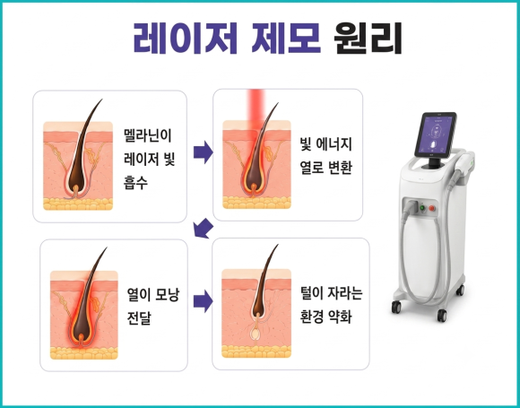 Yangcheon-gu Dermatology Clinic (Department: Dermatology): If You’re Looking for a Place That Excels at Laser Hair Removal image 2