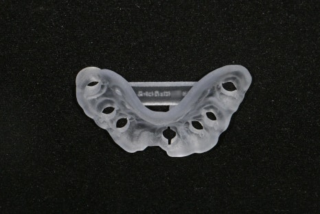 Songpa Station Dentist: Have You Been Using Dentures for a Long Time? <Digital Guided Implants> image 7