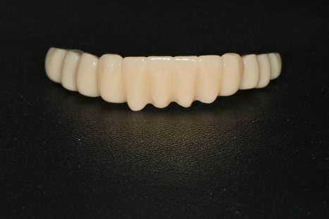 Temporary Teeth After Implants in Songpa-dong: Why They Can Be Provided Quickly image 7