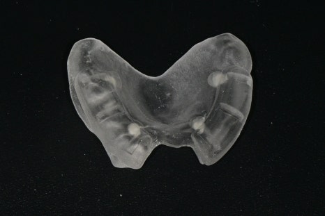 Songpa Station Dentist: Have You Been Using Dentures for a Long Time? <Digital Guided Implants> image 5