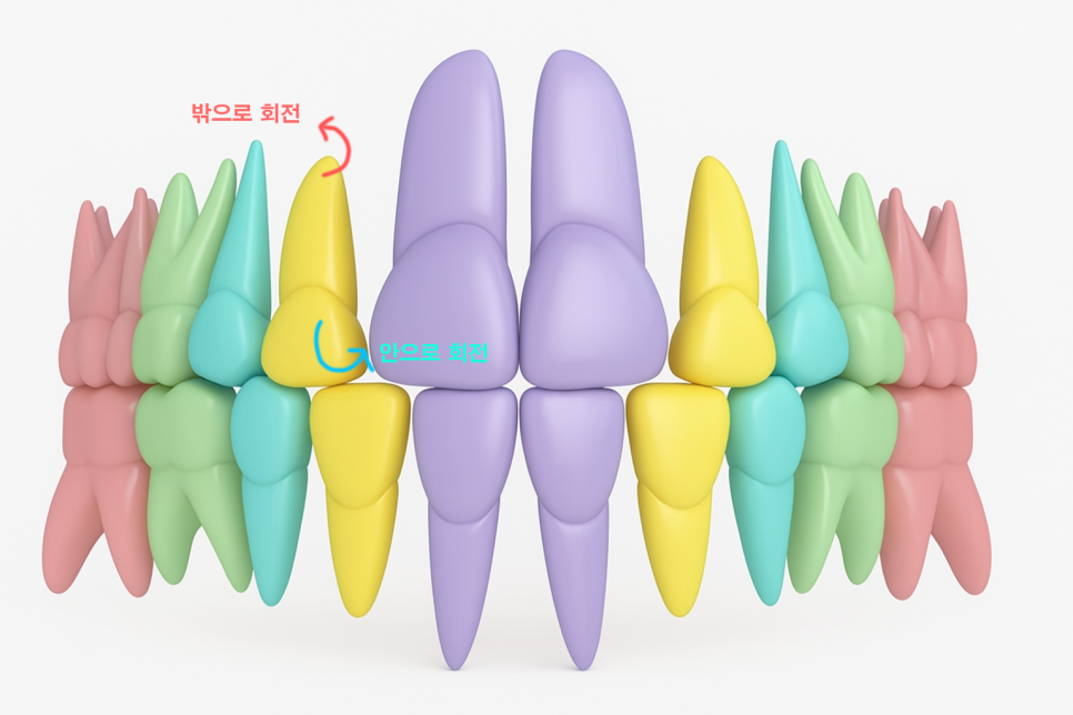 아이가 앞으로 넘어졌을 때 앞니 치료 확인법 거여역 치과 소아 치아 외상의 이해와 관리 관련 이미지 6