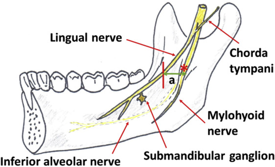 매복과잉치 를 발치할 때 CT 촬영이 필요한 이유? 연세다감치과 의학 정보 전달 글 관련 이미지 12