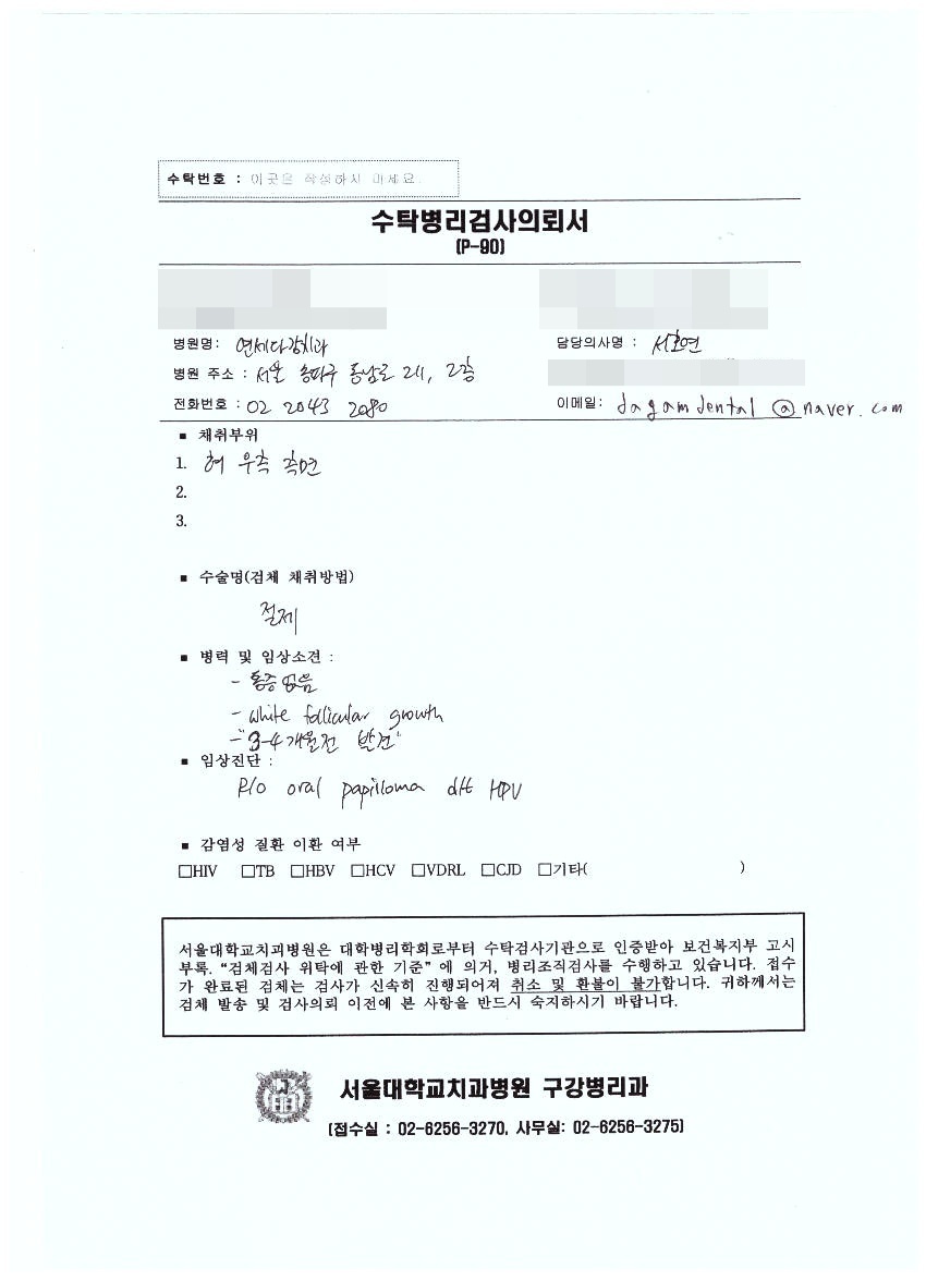 개롱역 치과 혀에 하얀 돌기? 구강 유두종 작아도 조직검사가 필요한 이유 관련 이미지 7
