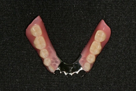 Seokchon-dong Dental Clinic, 연세다감치과: Why You Should Carefully Review the Denture-Making Steps · Process from the Beginning image 4