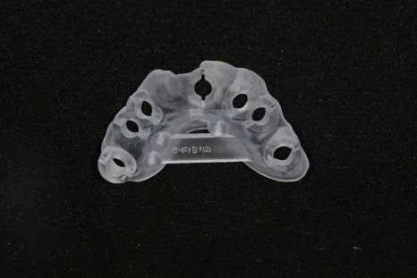 Songpa Station Dentist: Have You Been Using Dentures for a Long Time? <Digital Guided Implants> image 8