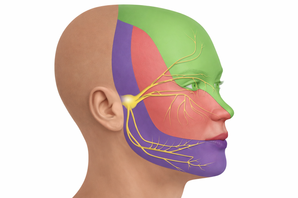 갑자기 얼굴에 찌릿한 날카로운 통증 치아 원인이 아니라면 삼차신경통 의심 문정동 치과 에서 알아보는 치료 방법 관련 이미지 4