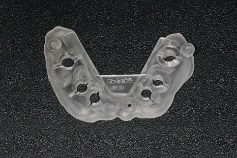 Temporary Teeth After Implants in Songpa-dong: Why They Can Be Provided Quickly image 6