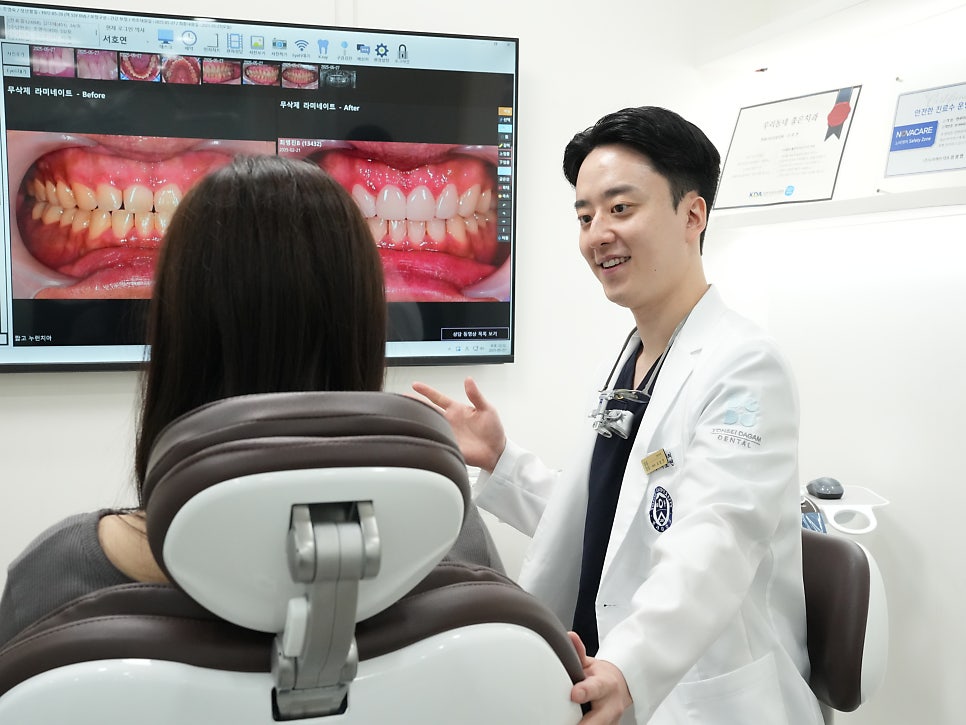 연세다감치과의 치아 깍지 않는 무삭제 라미네이트 (시술 후 변화와 관리법) 관련 이미지 3