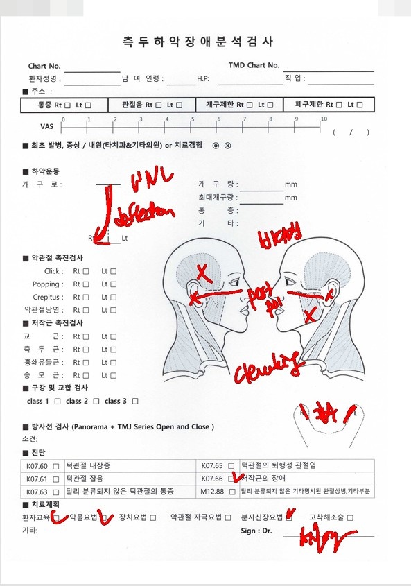 입 벌릴 때 불편하다면? 이갈이로 인한 통증 턱관절 증상 보톡스가 필요한 이유 가락동 치과 관련 이미지 6