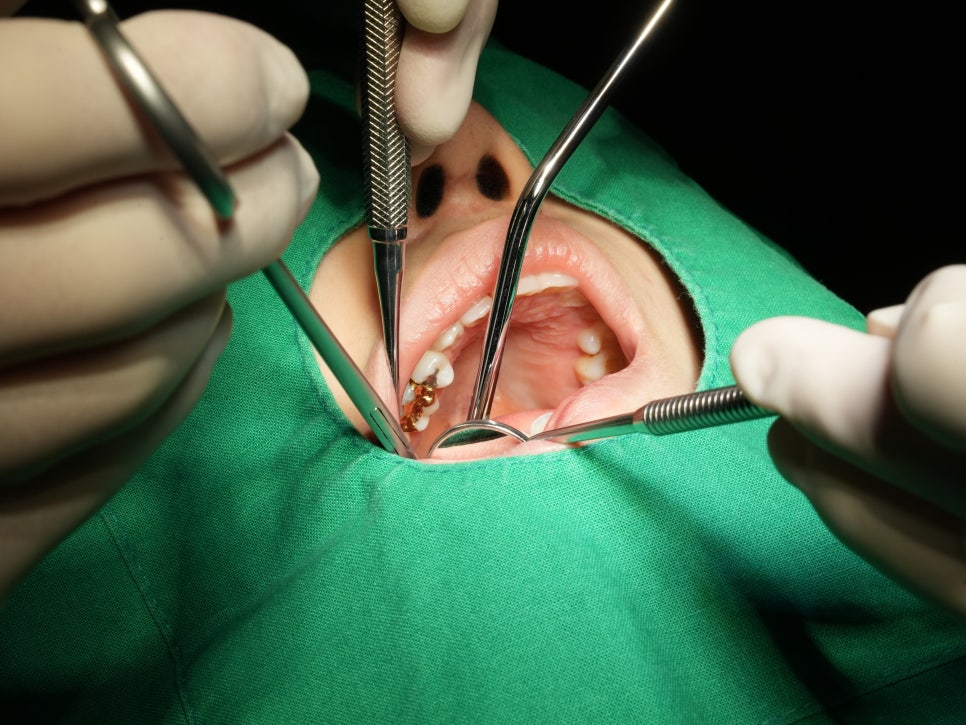 연세다감치과의 수면마취 치과치료 (의식하 진정요법) 관련 이미지 6