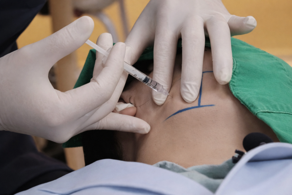 입 벌릴 때 불편하다면? 이갈이로 인한 통증 턱관절 증상 보톡스가 필요한 이유 가락동 치과 관련 이미지 5