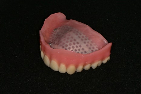 Seokchon-dong Dental Clinic, 연세다감치과: Why You Should Carefully Review the Denture-Making Steps · Process from the Beginning image 3