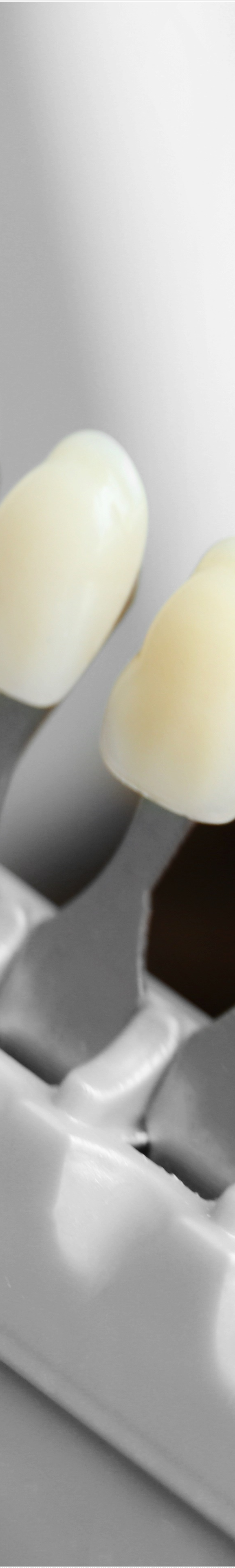 을지로입구역치과에서 알려드리는 치아미백과 라미네이트의 모든 것 관련 이미지 18