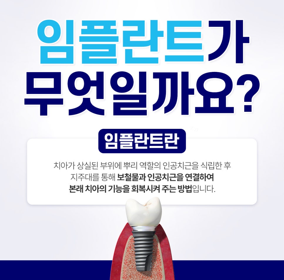 종로치과추천 나이별 &middot; 상황별 임플란트 치료 방법 관련 이미지 5