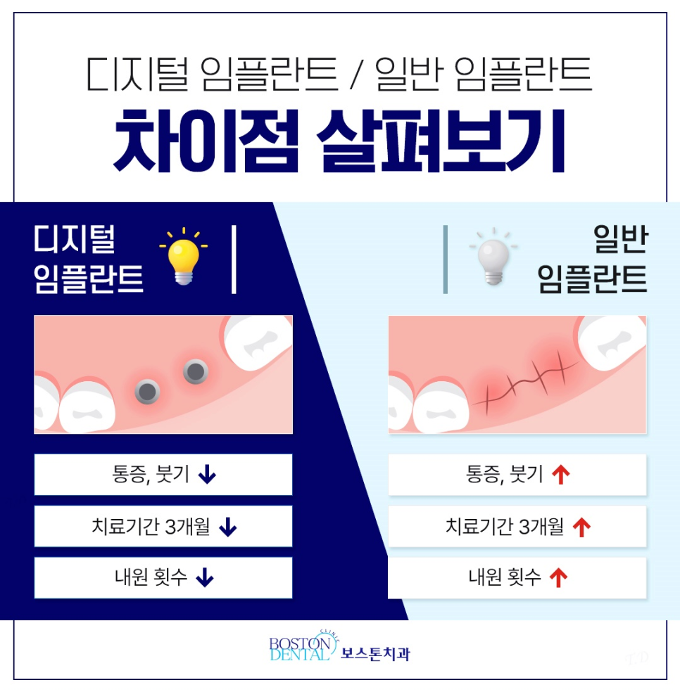 을지로입구역치과 오래 사용 가능한 임플란트 관련 이미지 4