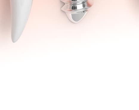 종각치과 너무 많은 치과 치료가 헷갈린다면? 관련 이미지 19