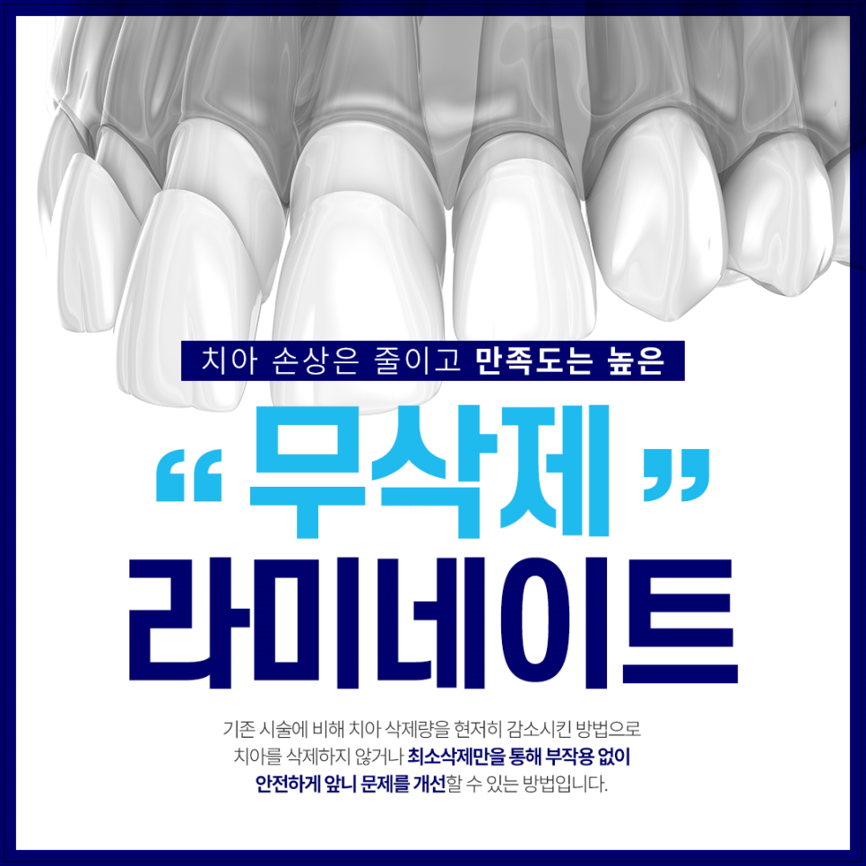 광화문치과 라미네이트 깨짐&middot;들뜸 원인과 예방 방법 완벽 정리 관련 이미지 1