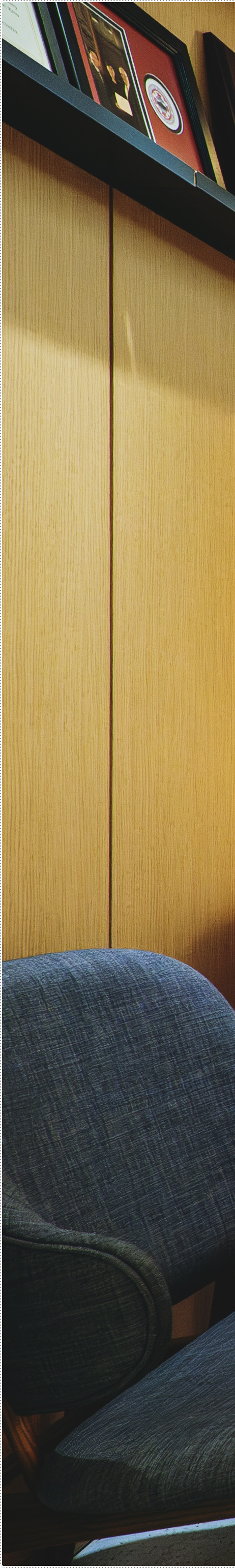 을지로치과 눈에띄지 않게 교정할 수 있는 방법 관련 이미지 32