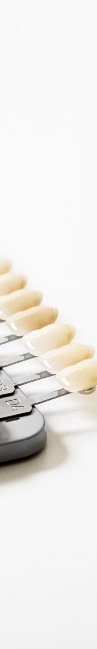 명동치과 주변 치아와 자연스러운 라미네이트 하는 방법 관련 이미지 16