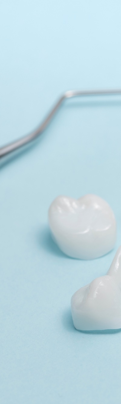 명동치과 주변 치아와 자연스러운 라미네이트 하는 방법 관련 이미지 7