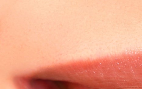 종로치과 치아미백 밝고 환하게 관련 이미지 16