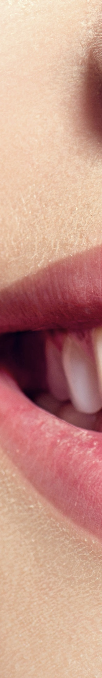 광화문역치과 치아미백과 라미네이트의 차이는? 관련 이미지 5