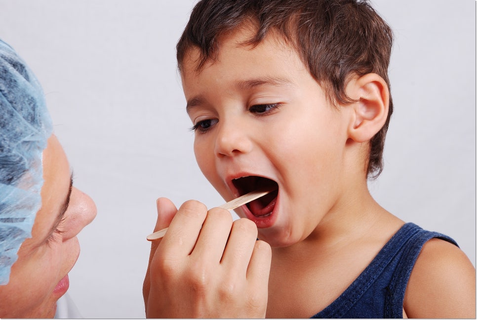 충치는 왜 생기는 것일까요? 관련 이미지 2