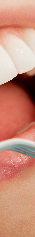 광화문치과 치아미백 그 후 관련 이미지 14