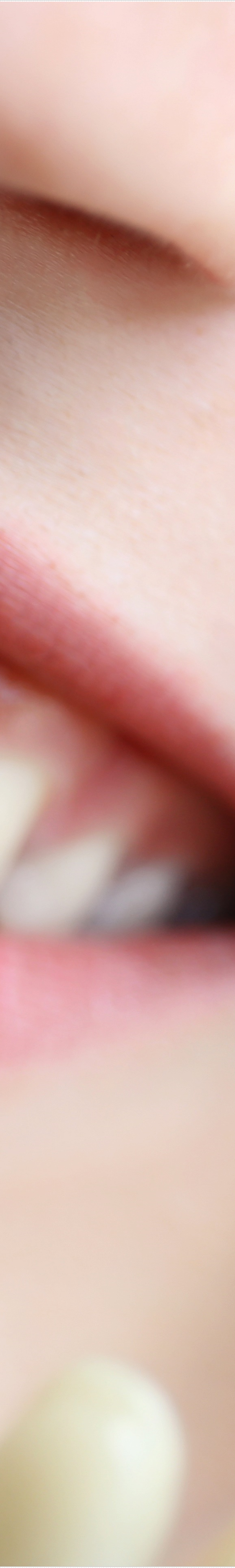 을지로입구역치과에서 알려드리는 치아미백과 라미네이트의 모든 것 관련 이미지 24