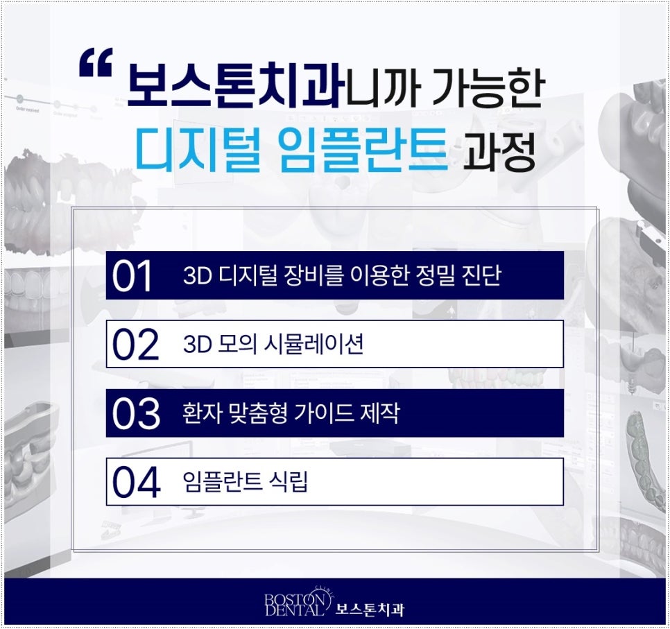 외국인치과 임플란트 정밀 진단 후 안전하게 식립 관련 이미지 5