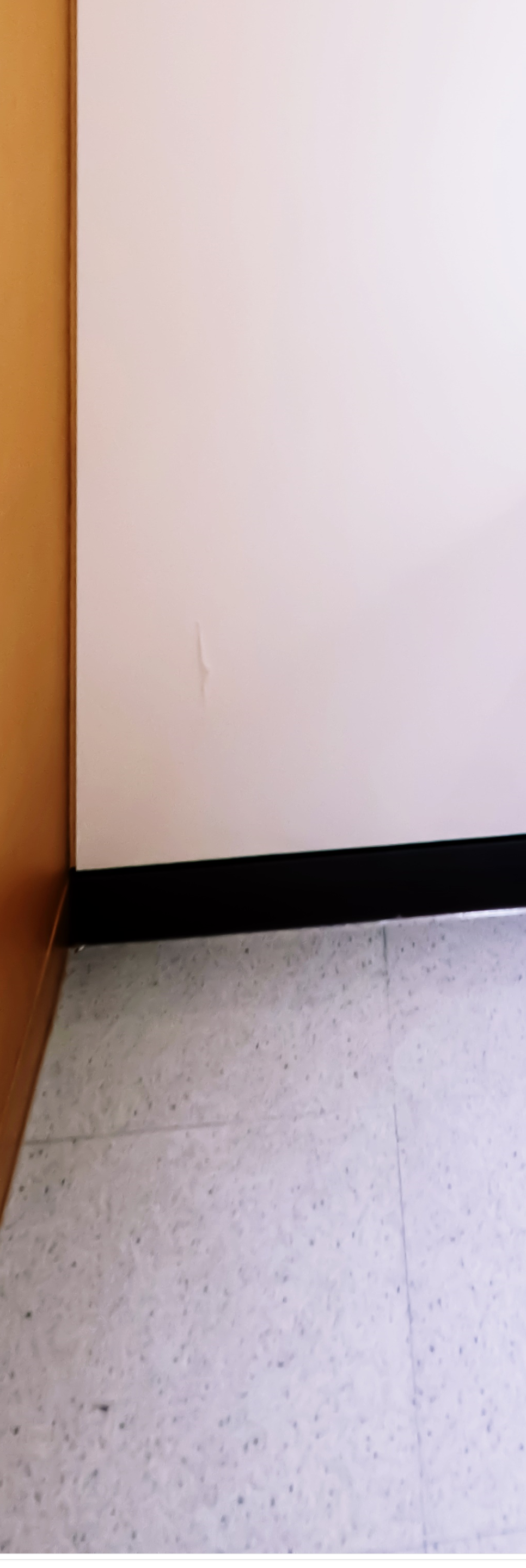 명동치과 저작력을 회복하기 위해서는? 관련 이미지 38