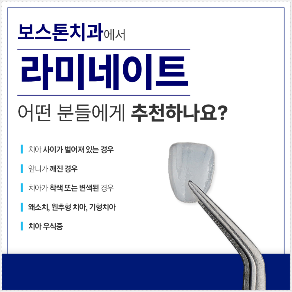 종로치과 자연스러운 라미네이트 색, 얼마나 하얘야 예쁠까? 관련 이미지 2