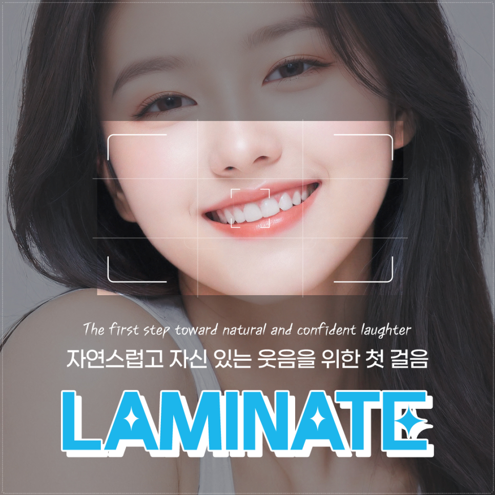 종로치과에서 알려주는 라미네이트 치료 가이드 관련 이미지 2