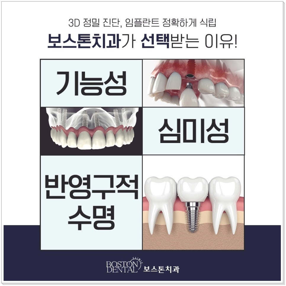 명동치과에서 치아식립 받아 건강을 챙겨요 관련 이미지 3