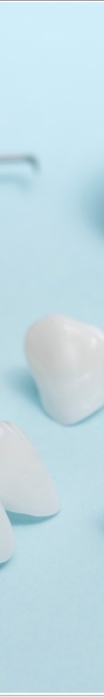 광화문치과 라미네이트 치료 전 고민해야 할 것 관련 이미지 37